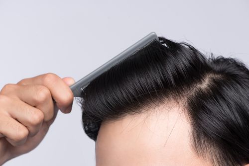 Dates can prevent hair loss