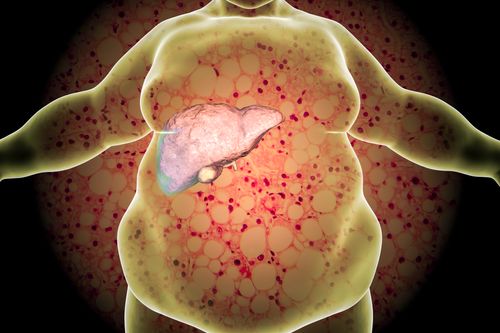 Fatty liver
