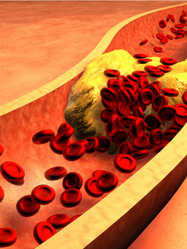 Natural Ways to Lower Cholesterol Levels