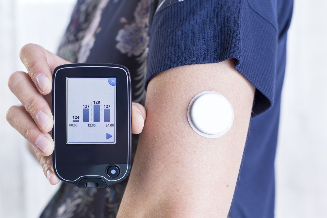 How Can Glucose Tracking Complement Our Weight Loss?