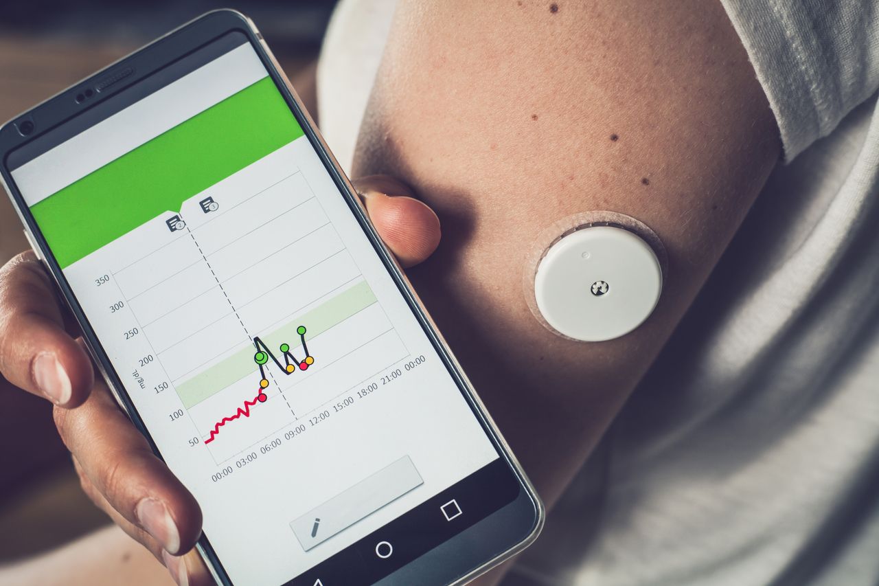 Benefits and Factors of Glucose Levels Monitoring