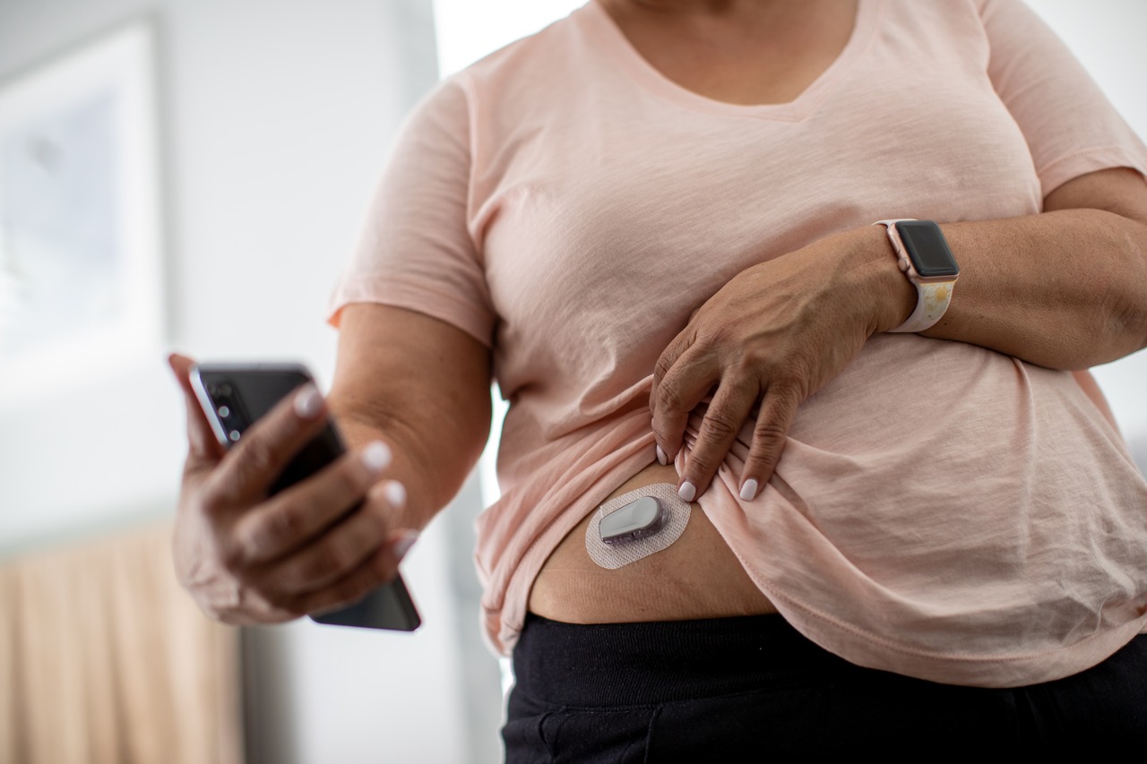 Glucose Tracking and Weight Management: A Link