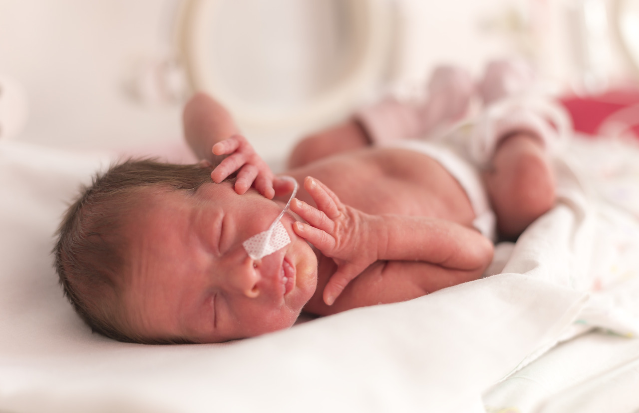 Premature Birth: Survival and Health Concerns